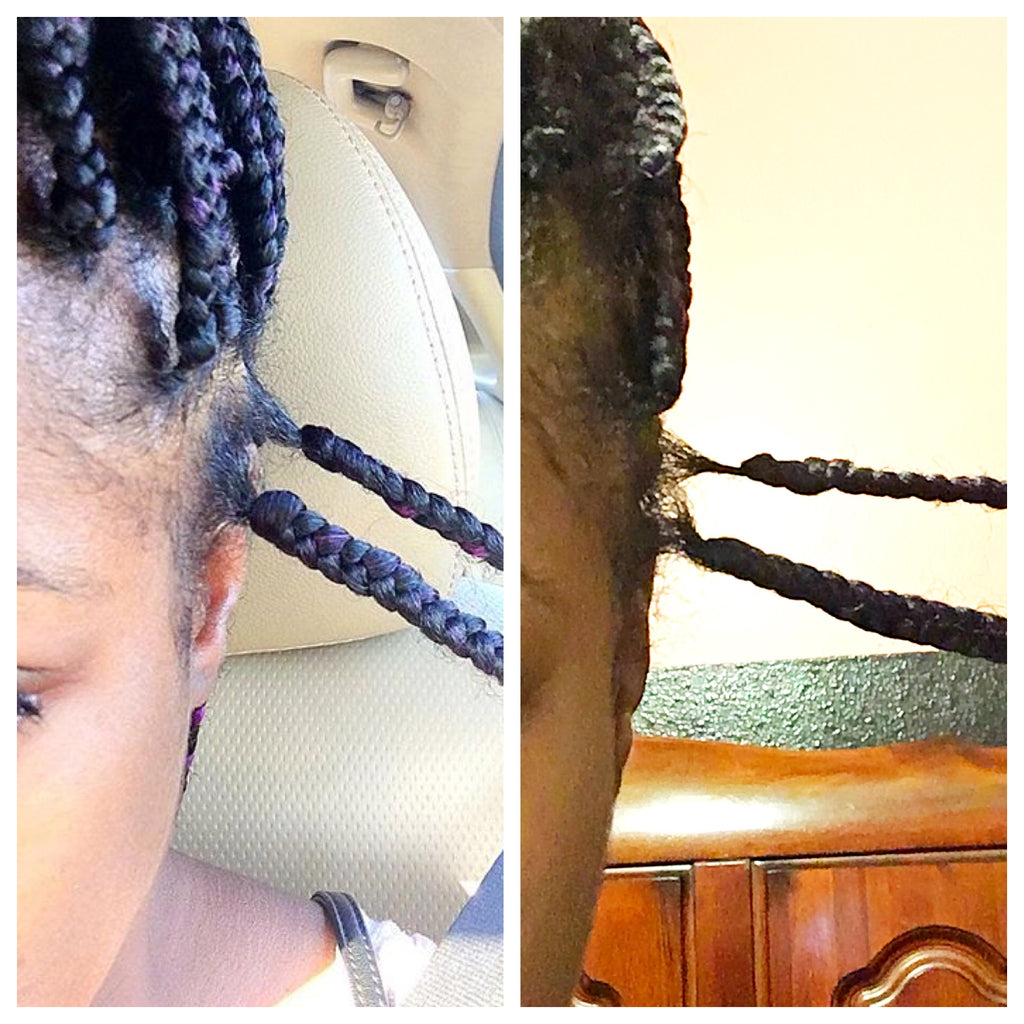 Advanced Scalp Treatment