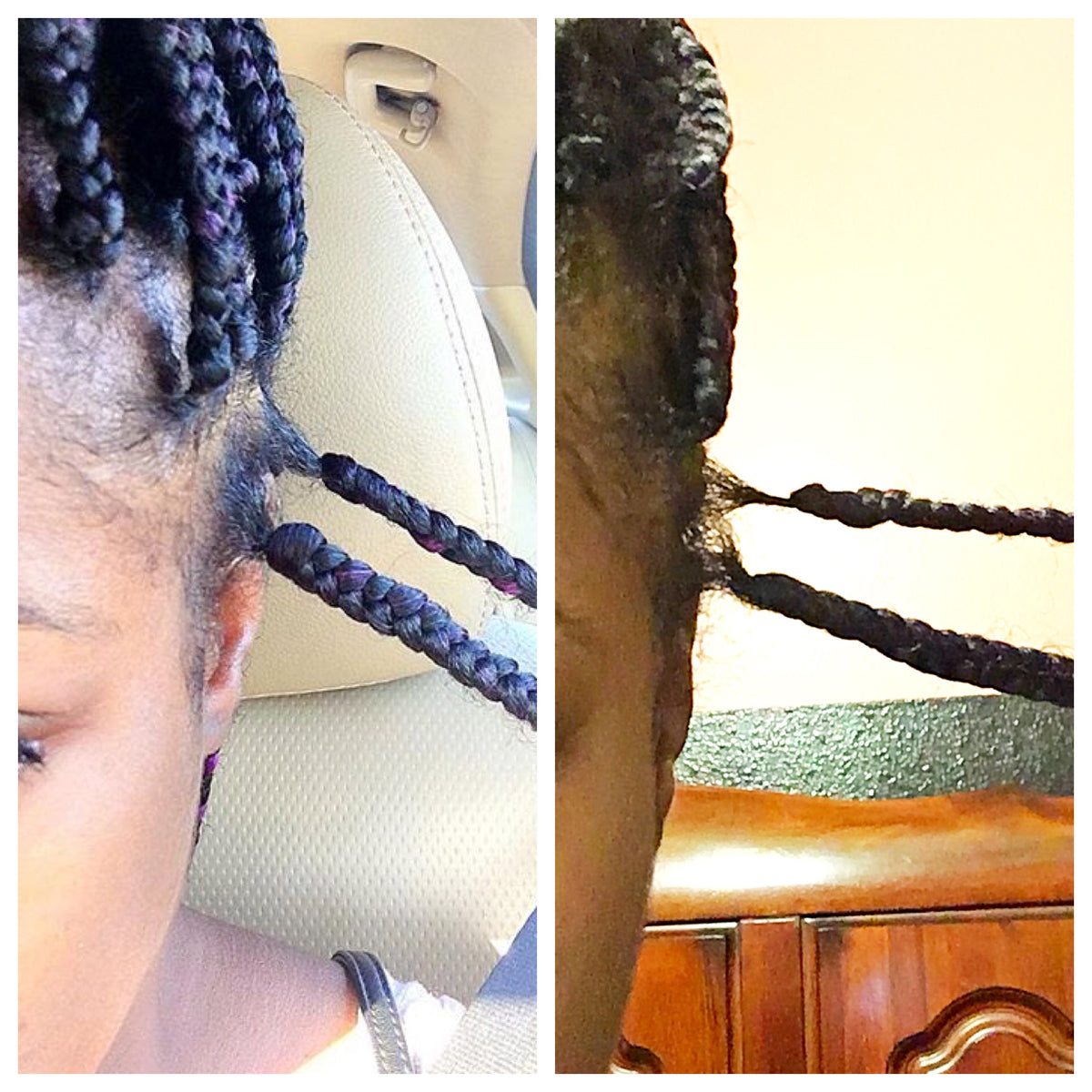 Advanced Scalp Treatment